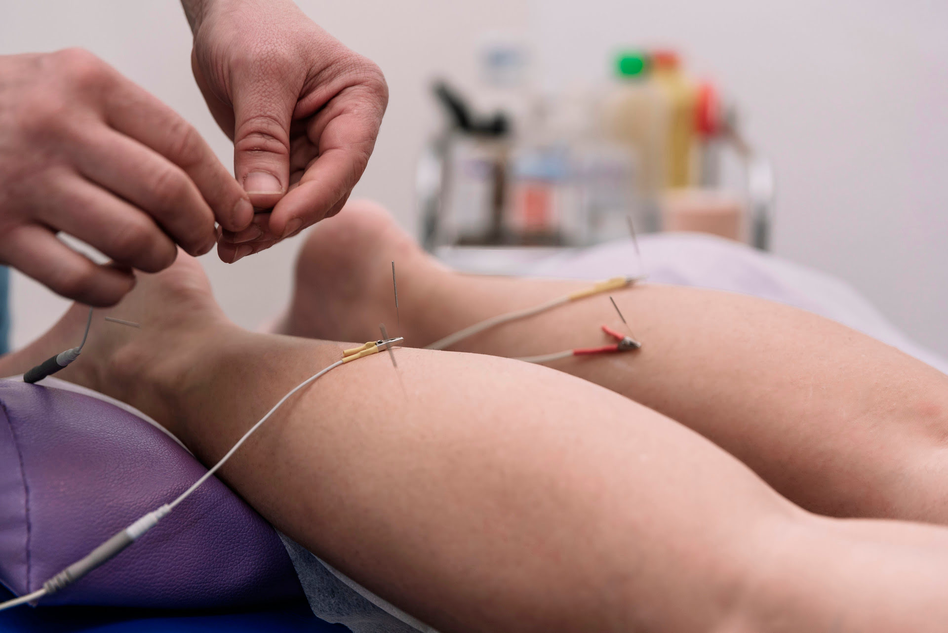 imagen sesión de electroacupuntura